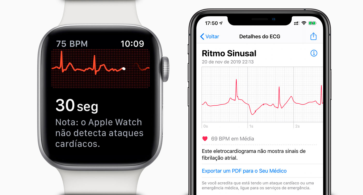 [hack] Kuidas Brasiilias mitteametlikult aktiveerida Apple Watchi EKG (UUENDATUD) »iPhone'i ajaveeb
