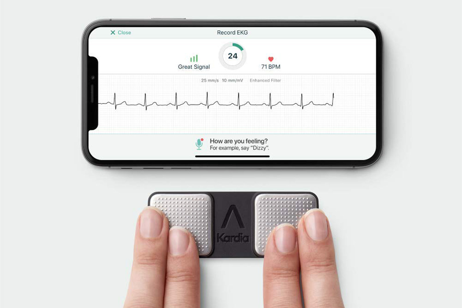 AliveCor iPhone'i lisavarustus suudab nüüd tuvastada veel kaks südame rütmihäiret -