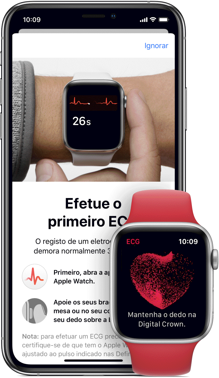 EKG - Apple Watch